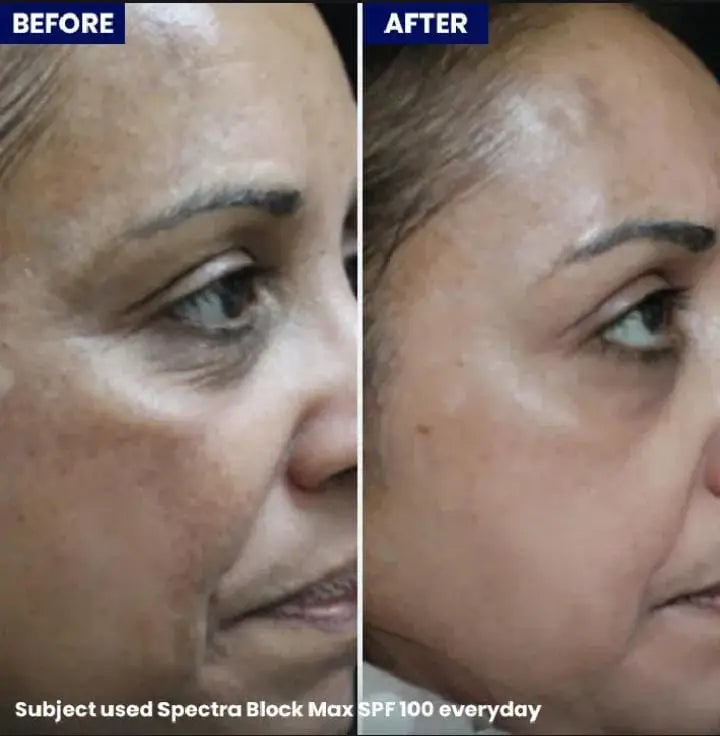 Spectra Block Max-SPF100+ Jenpharm