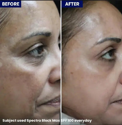 Spectra Block Max-SPF100+ Jenpharm
