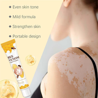 Vitigo Bee Venom Treatment Cream | Natural Skin Repair Hydration Relief Anti-Irritation